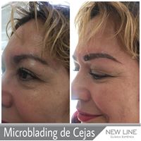 microblading de cejas -New Line Clínica Estética