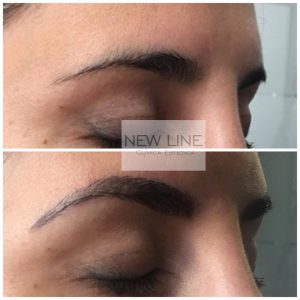microblading de cejas -New Line Clínica Estética